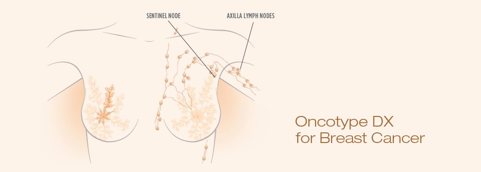 oncotypeDX.jpg