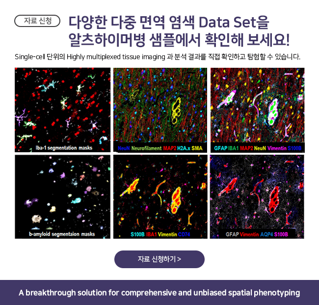 비엠에스