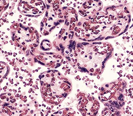 [STEMCELL 웨비나]  자가면역질환: Human primary cell과 mouse model 기반 연구 및 치료전략